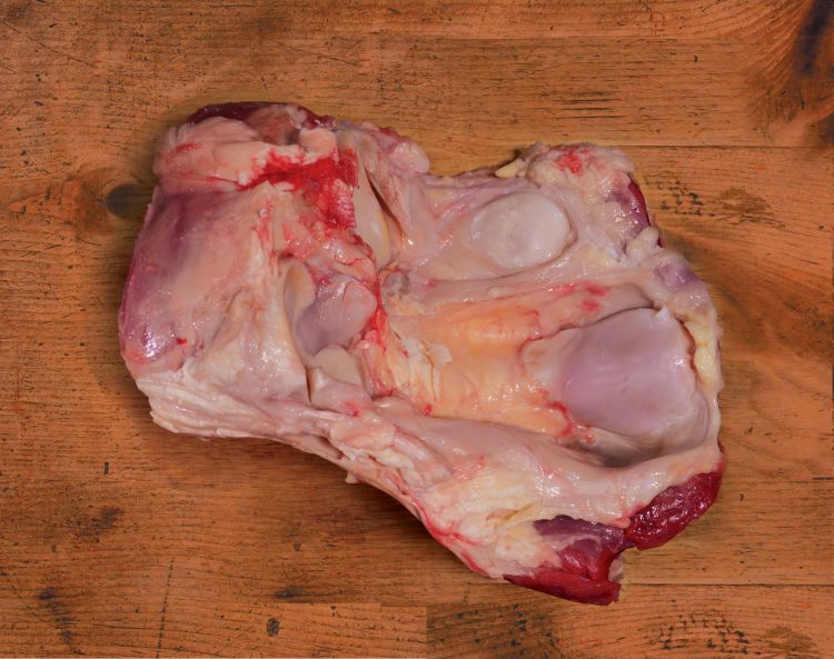 Knee Cap